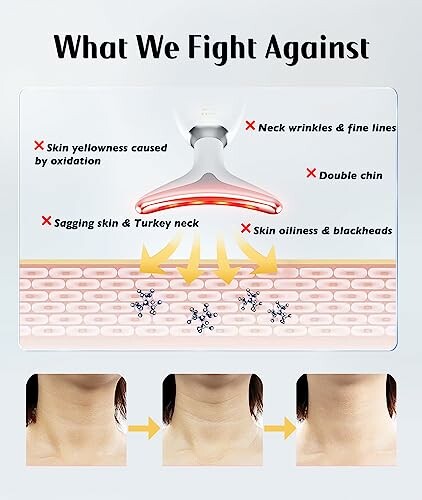 Illustration of skin issues targeted by treatment, including wrinkles, fine lines, and oiliness.